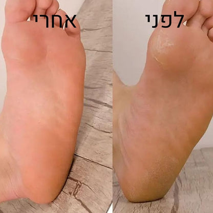 סופטפיט - כף רגל חלקה
